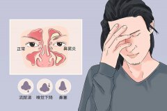 Ͼ׵ĳշЩ