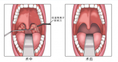 ϾǺרҽԺ_巢Щ֢״