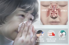 ����ж��Լ��Ƿ��бǼ׷ʴ�