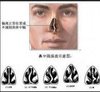 ���и�ƫ������Ҫ�������Ͼ����Ǻ���ҽ�����