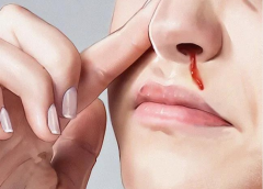 ����������Ѫ���������4��ԭ��